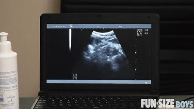 X-Ray Sex Examination: Daddy Licks Creamy Shrimp Boy, 18 Years Old Doctor Visit