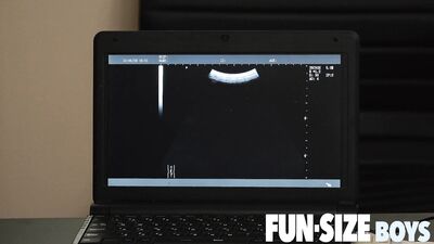 Sexe anal en ultrason